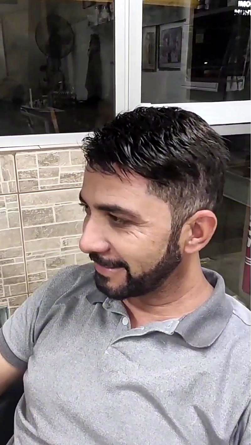 O mesmo cliente depois, com cabelo cheio, visto de lado